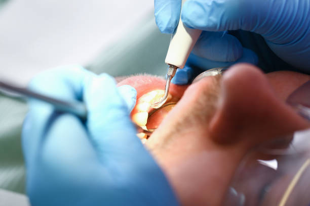 Best Emergency Dentist for Knocked-Out Tooth in Seaville, NJ