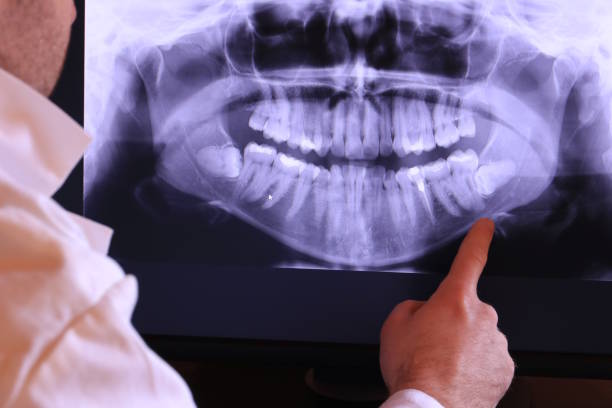 Best Emergency Dental Services for Seniors in Seaville, NJ